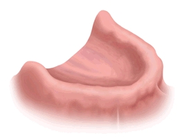 Neue Lebensqualität mit Implantaten Neue Lebensqualität mit Implantaten